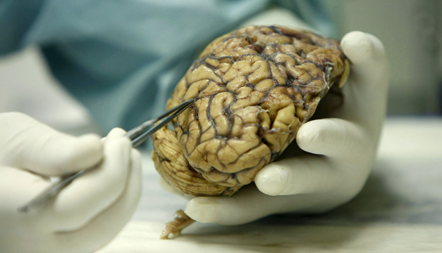Cerebro-EFE
