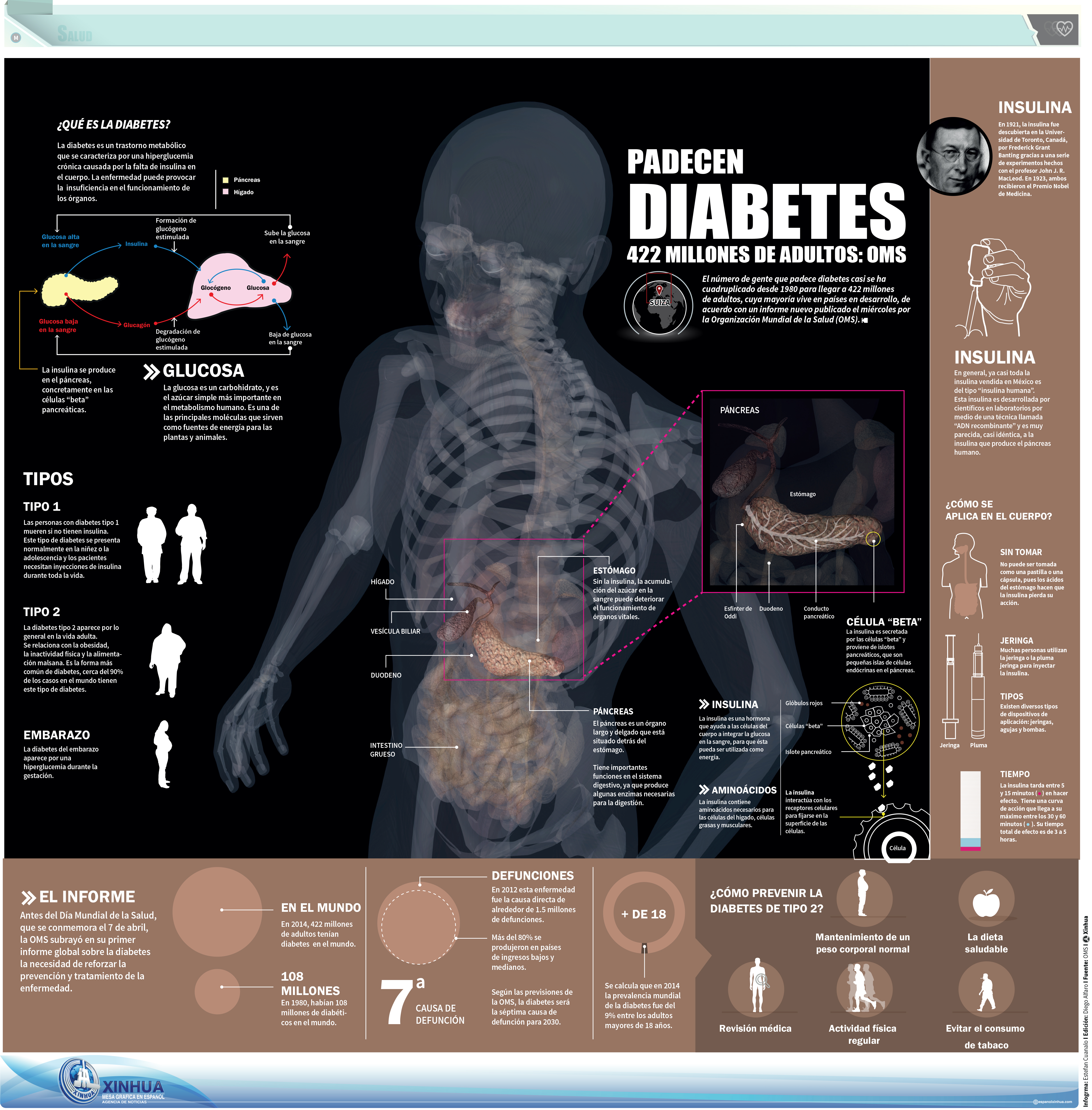 diabetes