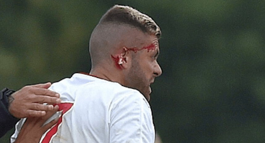 Oreja-Jeremy-Menez