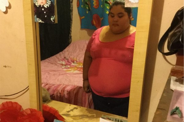 obesa-2