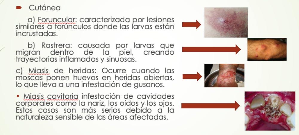 Tipos de manifestaciones cutáneas de gusano barrenador en humanos, según presentación del presidente del Colegio Médico, Iván Solano.