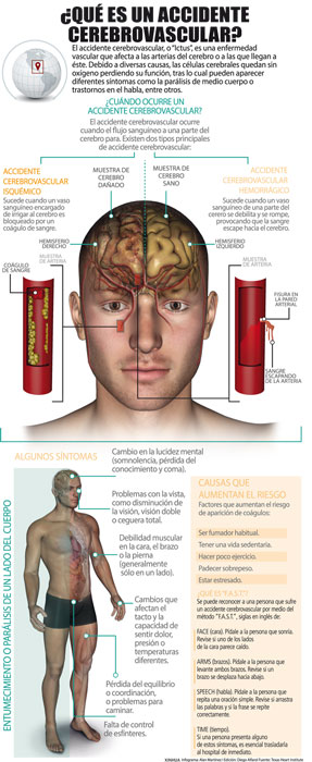 INFOGRAFIA