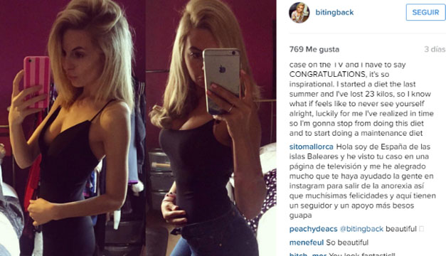 Nina-Anorexia