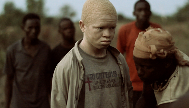 Albino