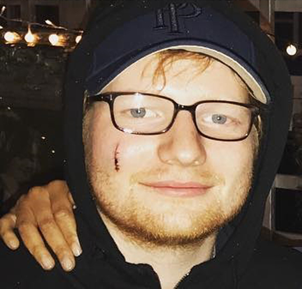 ed-sheeran-cortesia